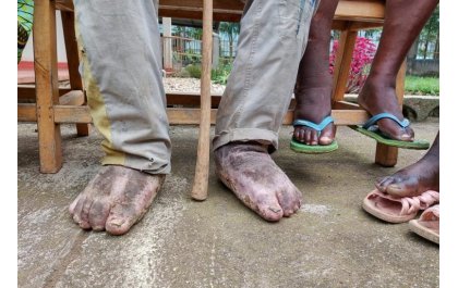 Abarenga 41% mu Rwanda barwaye inzoka zo mu nda n’izindi ndwara zititaweho